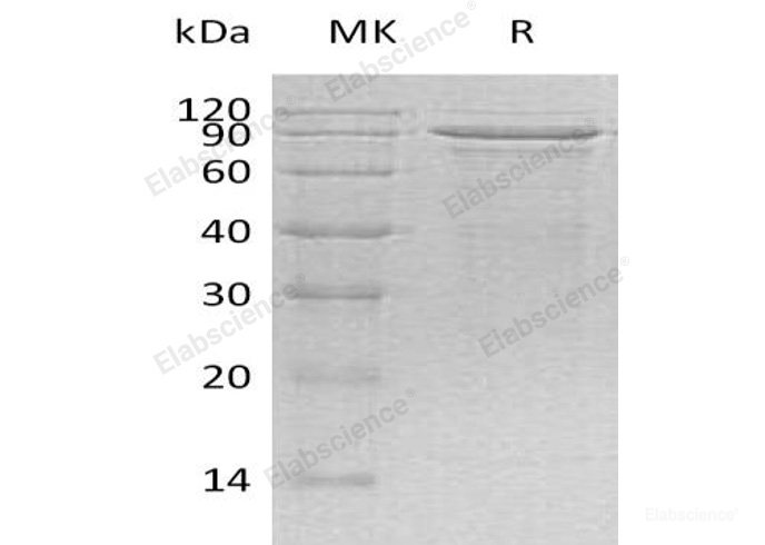 Recombinant Human Methyl-CpG-Binding Protein 2/MECP2 Protein(C-6His)-Elabscience