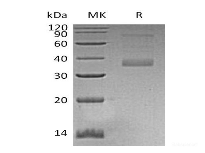 Recombinant Human Microfibril-Associated Glycoprotein 4/MFAP4 Protein(C-6His)-Elabscience