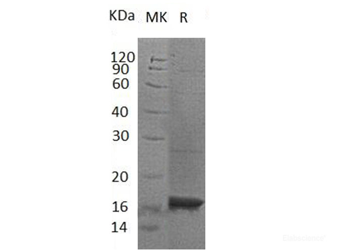 Recombinant Human Microtubule-Associated Protein 1 Light Chain 3 α/MAP1LC3A Protein(C-6His)-Elabscience