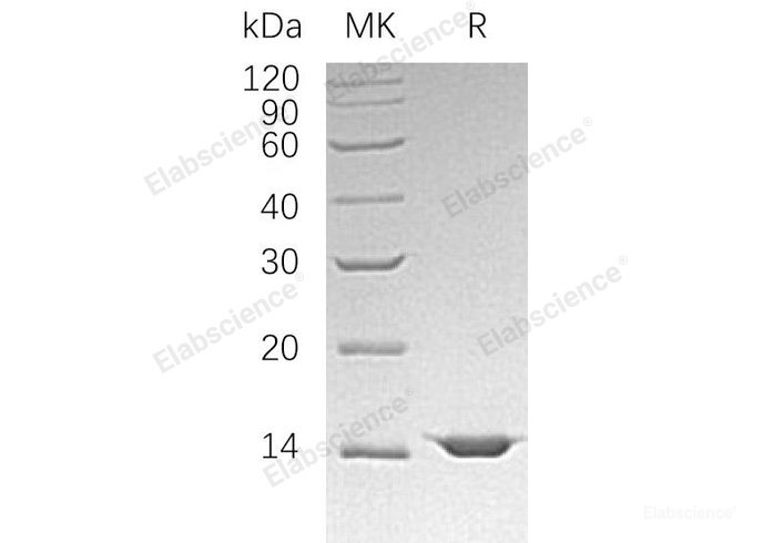 Recombinant Human Mitochondrial Fission 1 Protein/FIS1 Protein(C-6His)-Elabscience