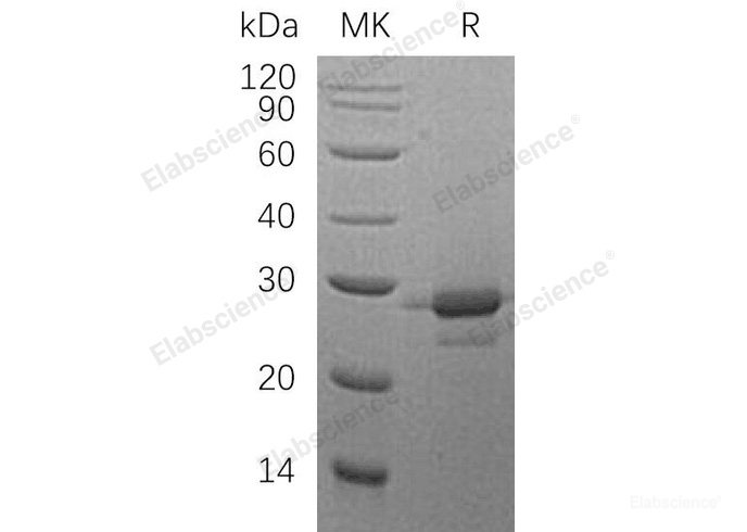 Recombinant Human MOB Kinase Activator 1A/MOB1A Protein(C-6His)-Elabscience