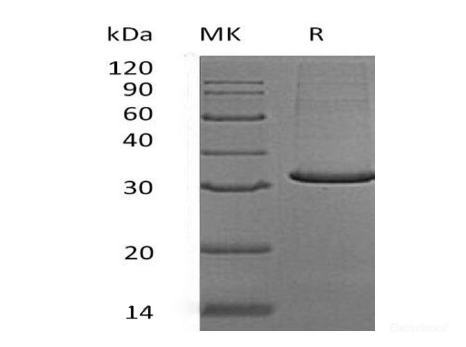 Recombinant Human MOB-Like Protein Phocein/MOB4/MOBKL3 Protein(N-6His)-Elabscience