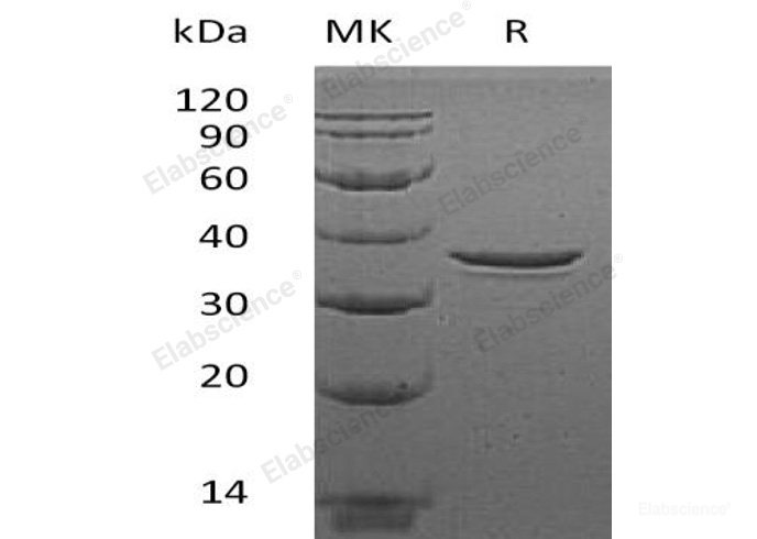 Recombinant Human Mortality Factor 4-Like Protein 2/MORF4L2/MRGX Protein(C-6His)-Elabscience