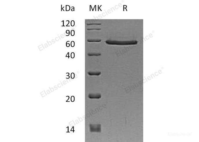 Recombinant Human Mothers Against Decapentaplegic Homolog 3/SMAD3 Protein(N-6His-Flag)-Elabscience