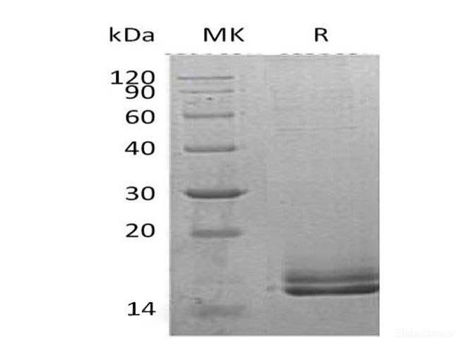 Recombinant Human Motilin Protein(C-6His)-Elabscience