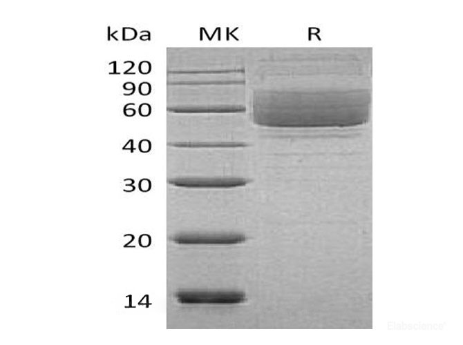 Recombinant Human Mucin-1/MUC-1 Protein(C-Fc)-Elabscience