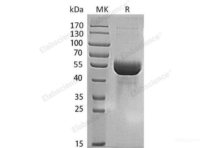 Recombinant Human Multiple Inositol Polyphosphate Phosphatase 1/MINPP1 Protein(C-6His)-Elabscience