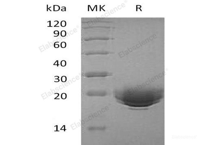 Recombinant Human Myelin Oligodendrocyte Glycoprotein/MOG Protein(C-6His)-Elabscience