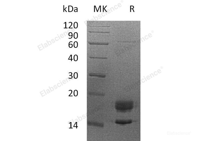 Recombinant Human Myelin Protein P0/MPZ Protein(C-6His)-Elabscience