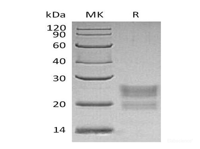 Recombinant Human Myelin Protein P0-like 1/MPZL1 Protein(C-6His)-Elabscience