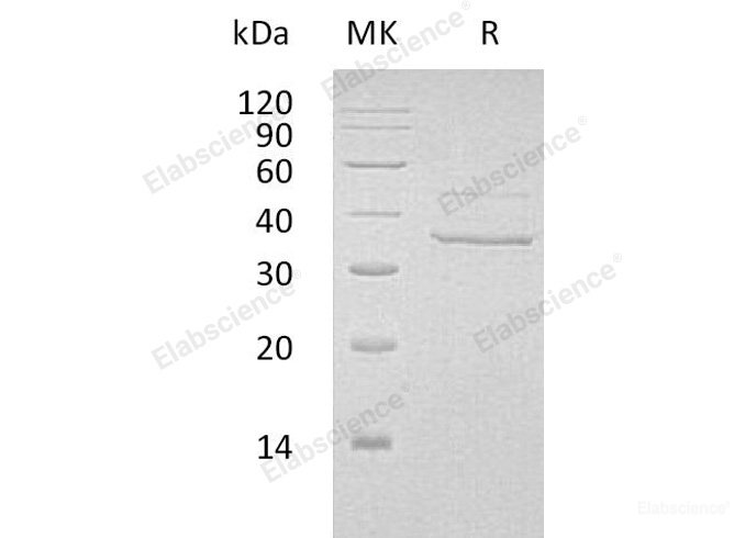 Recombinant Human Myozenin-2/MYOZ2 Protein(C-6His)-Elabscience