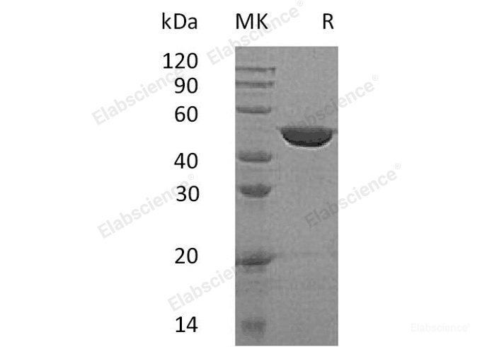 Recombinant Human N-Acetylgalactosamine kinase/GALK2 Protein(C-6His)-Elabscience
