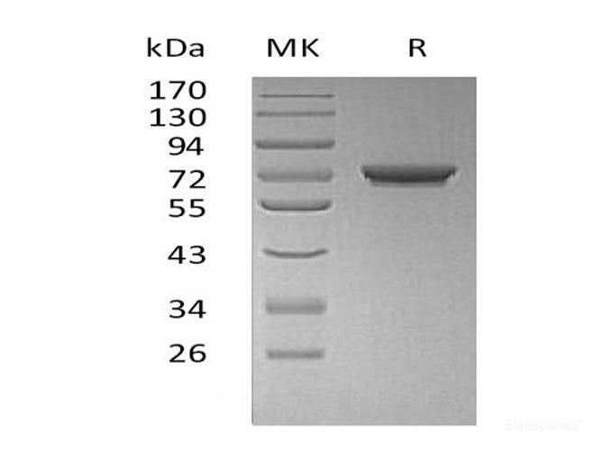 Recombinant Human N-Acetylgalactosaminyltransferase 7/GALNT7 Protein(C-6His)-Elabscience