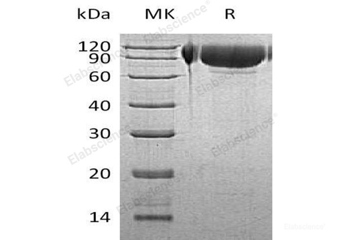 Recombinant Human N-Acetylglucosamine-6-Sulfatase/GNS Protein(C-6His)-Elabscience
