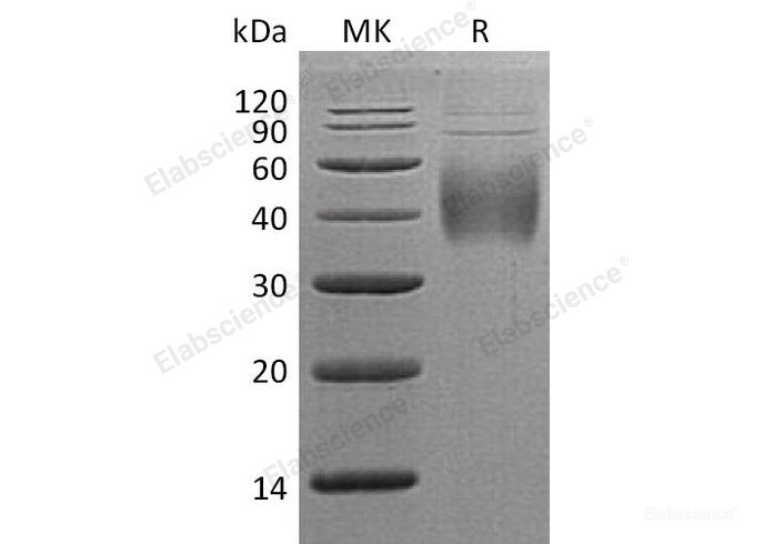 Recombinant Human Natural Killer Cell Receptor 2B4/SLAMF4/CD244 Protein(C-6His)-Elabscience