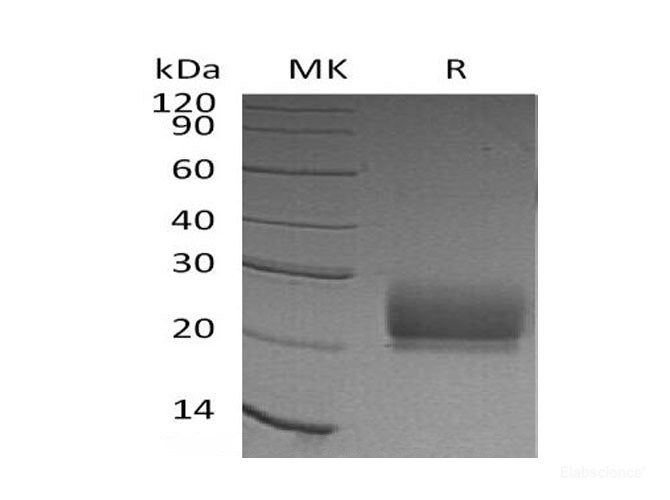 Recombinant Human Natural Killer Cells Antigen CD94/CD94 Protein(N-6His)-Elabscience