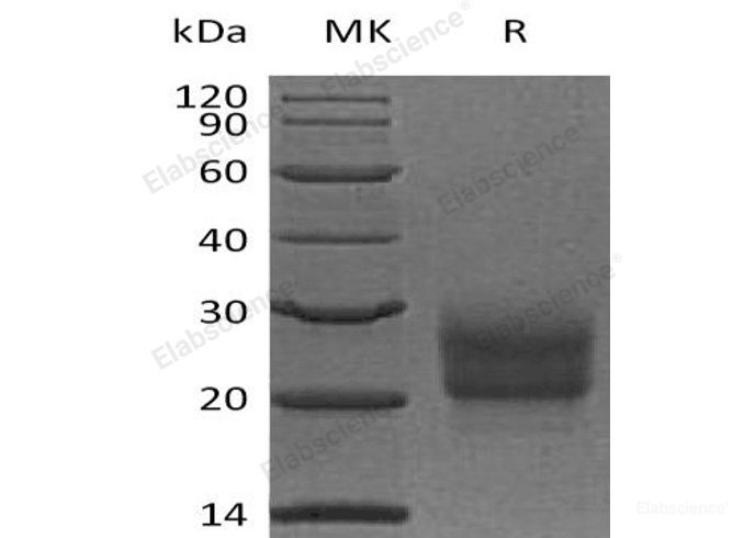 Recombinant Human NCR3/NKp30/CD337 Protein(C-6His)-Elabscience