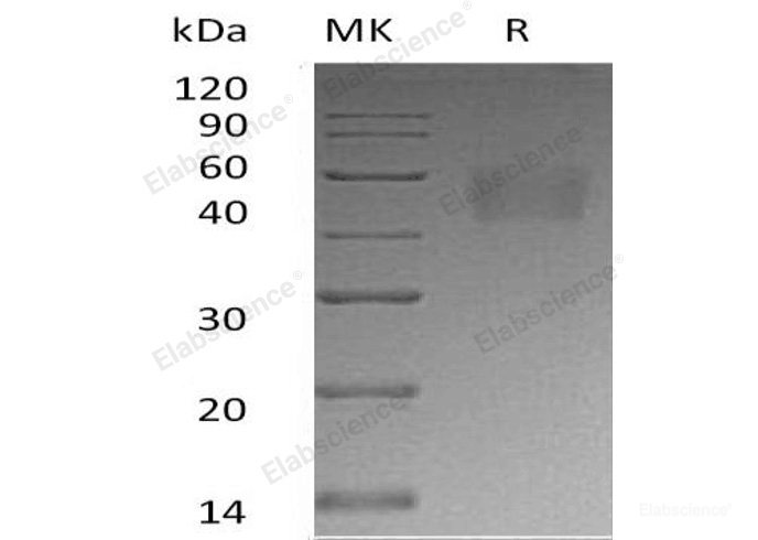 Recombinant Human Nectin-3/PVRL3/CD113 Protein(C-6His)-Elabscience