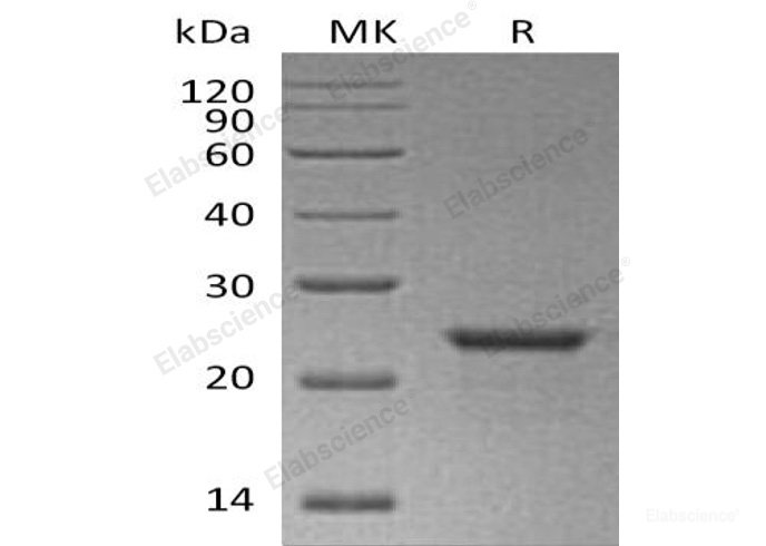Recombinant Human NEDD8 Protein(N-6His, SUMO tag)-Elabscience