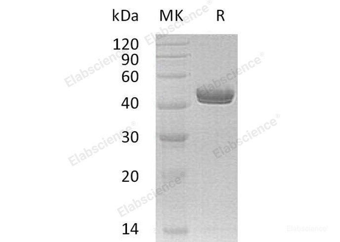 Recombinant Human Netrin-G1/NTNG1 Protein(C-6His)-Elabscience