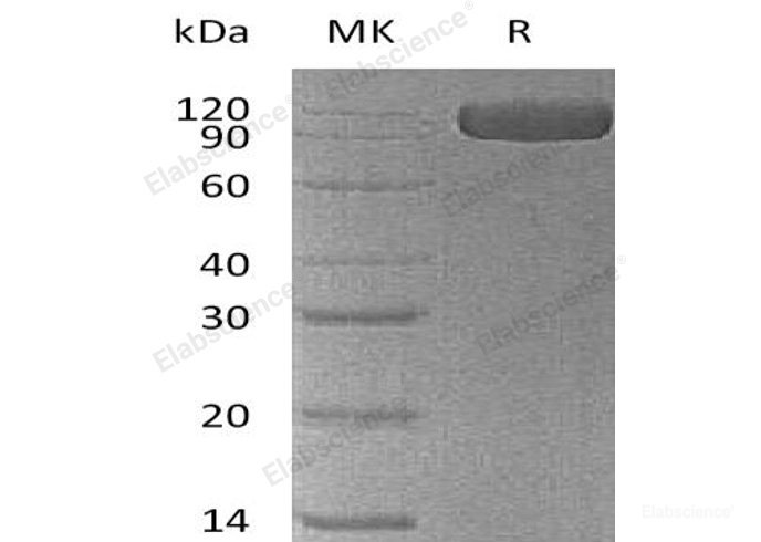 Recombinant Human Neural Cell Adhesion Molecule 1/NCAM-1/CD56 Protein(C-6His)-Elabscience