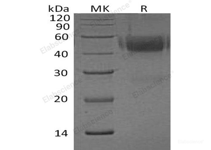 Recombinant Human Neurexophilin-1/NXPH1 Protein(C-6His)-Elabscience
