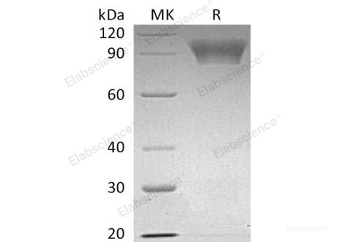 Recombinant Human Neuroligin 4, X-Linked/NLGN4X Protein(C-6His)-Elabscience