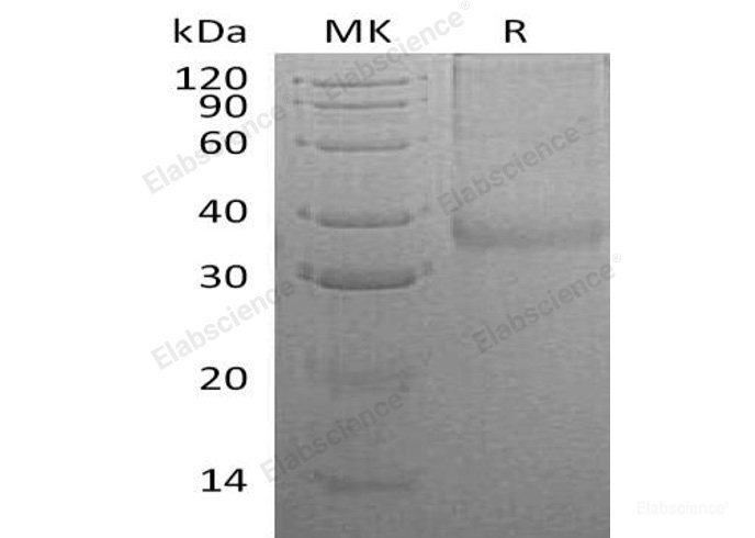 Recombinant Human Neuronal Acetylcholine Receptor Subunit β-3/CHRNB3 Protein(C-6His)-Elabscience
