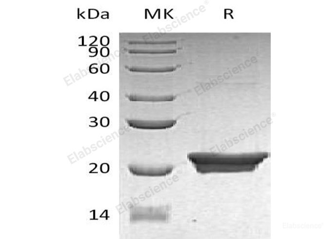 Recombinant Human NGAL/Lipocalin-2/LCN2 Protein(C-6His)-Elabscience
