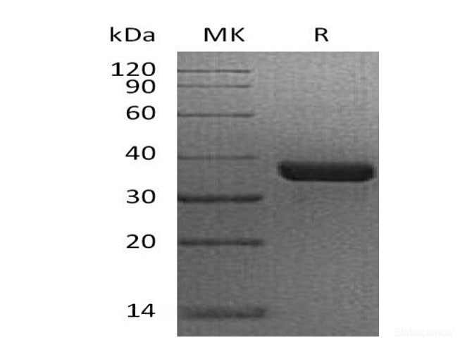 Recombinant Human N-Glycosylase/OGG1 Protein(N-GST)-Elabscience