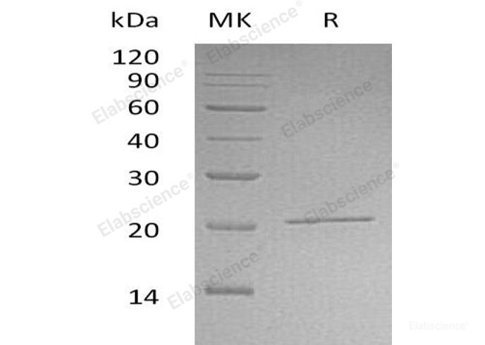 Recombinant Human NIP7/KD93 Protein(N-6His)-Elabscience