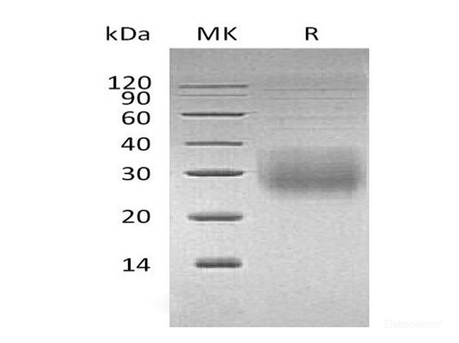 Recombinant Human NKG2A & CD94 Heterodimer Protein(N-8His & N-Flag)-Elabscience