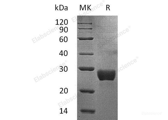 Recombinant Human NKG2D Ligand 1/NKG2DL/ULBP1 Protein(C-6His)-Elabscience