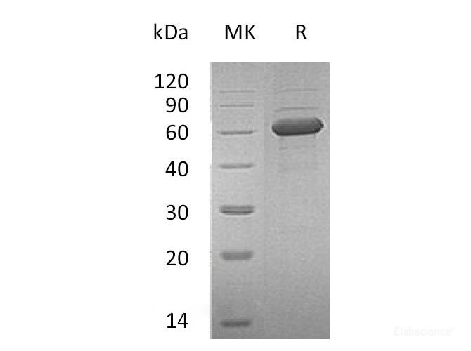 Recombinant Human NKG2D Ligand 1/NKG2DL/ULBP1 Protein(C-Fc)-Elabscience