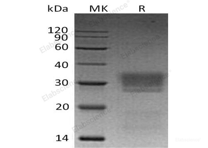 Recombinant Human NKG2D Ligand 2/NKG2DL2/N2DL2 Protein(C-6His)-Elabscience