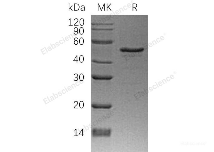 Recombinant Human N-myc Downstream Regulated Gene 1/NDRG1/DRG-1CAP43 Protein(N-6His)-Elabscience