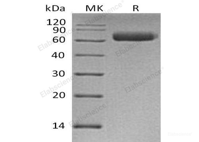 Recombinant Human Nogo-66 Receptor-Related 3/NgR3/RTN4RL1 Protein(C-6His)-Elabscience