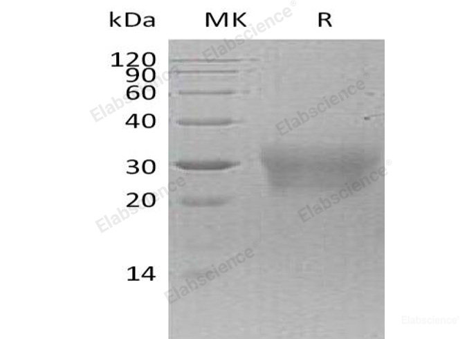 Recombinant Human NPDC1/CAB1 Protein(C-6His)-Elabscience