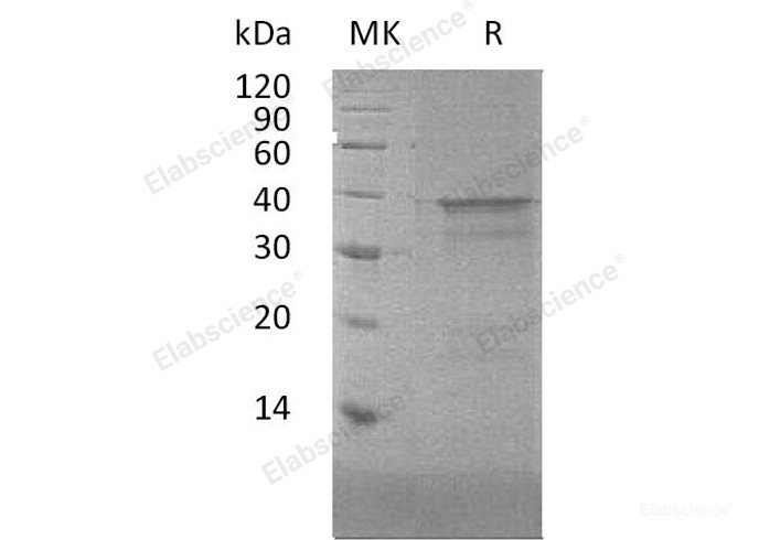 Recombinant Human Nuclear Transcription Factor Y Subunit α/NFYA Protein-Elabscience