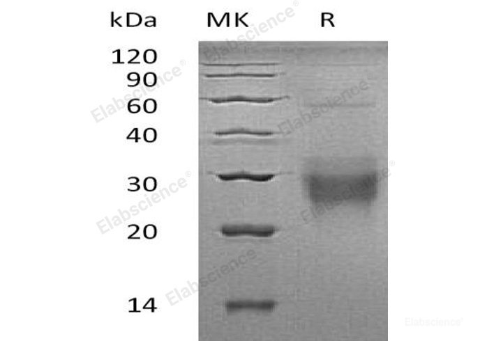 Recombinant Human Nuclear Transcription Factor Y Subunit α/NFYA Protein(N-GST)-Elabscience