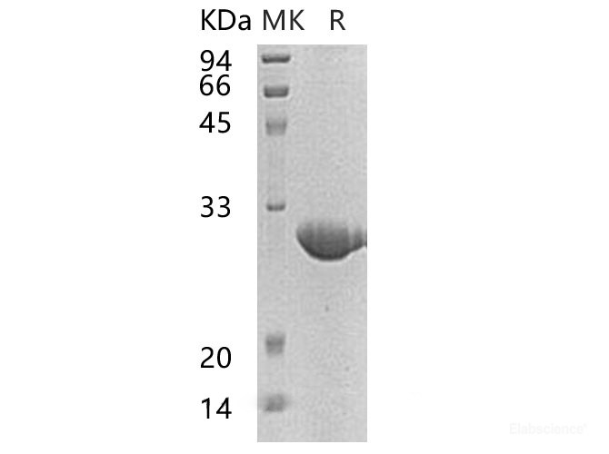 Recombinant Human Nucleolar Protein 3/NOL3 Protein(His)-Elabscience
