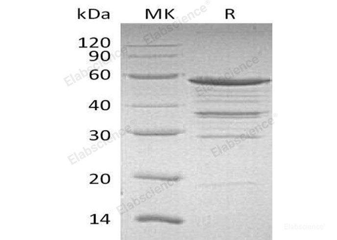 Recombinant Human Nucleolar Protein 3/NOL3 Protein(N-GST)-Elabscience
