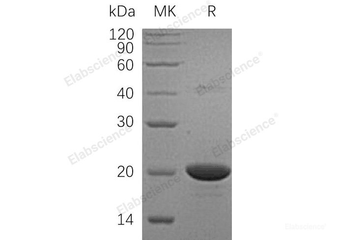 Recombinant Human Nucleoside Diphosphate Kinase A/NDPKA Protein(N-6His)-Elabscience