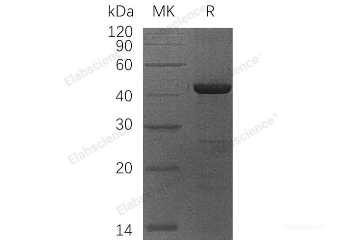 Recombinant Human OBFC1/CST Complex Subunit STN1 Protein(N-6His)-Elabscience