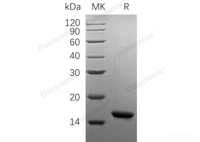 Recombinant Human Oncomodulin-1/OM Protein(N-6His)-Elabscience