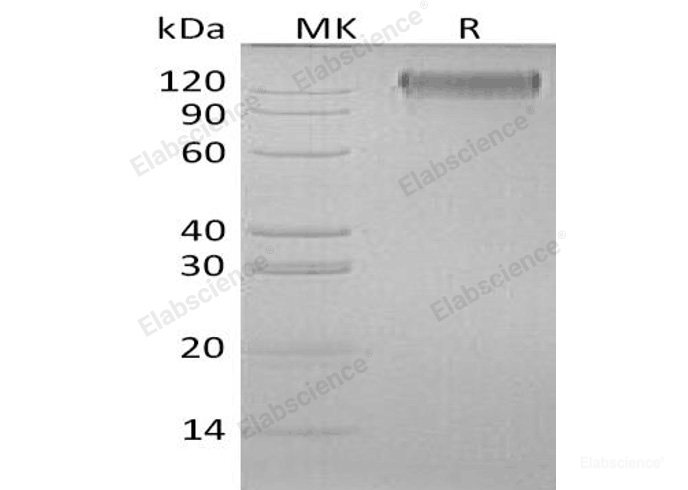 Recombinant Human Oncostatin-M-Specific Receptor Subunit β/OSMRB/IL-31RB Protein(C-6His)-Elabscience
