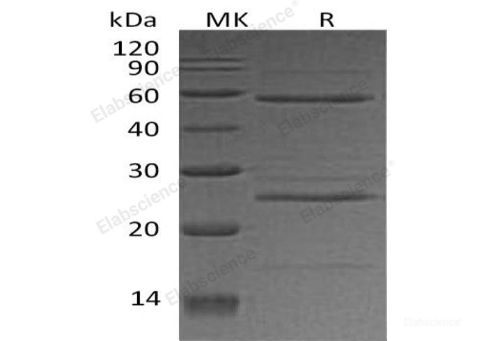 Recombinant Human Ornithine Decarboxylase/ODC1 Protein(C-6His, N-T7 tag)-Elabscience