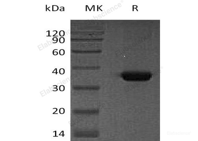 Recombinant Human Osteonectin/SPARC/BM-40 Protein(C-6His)-Elabscience