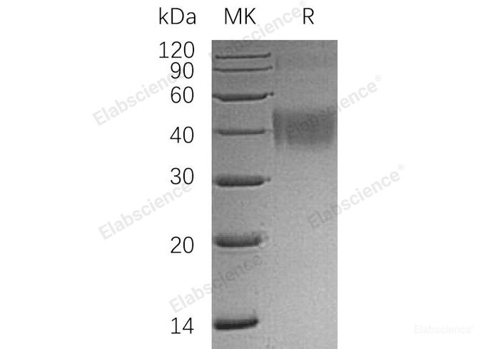 Recombinant Human OX-2/MOX1/CD200 Protein(C-6His)-Elabscience