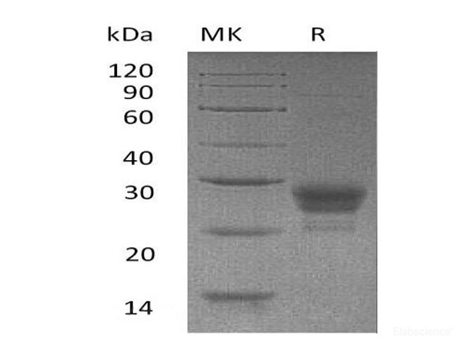 Recombinant Human OX40 Ligand/TNFSF4/OX40L Protein(N-6His)-Elabscience